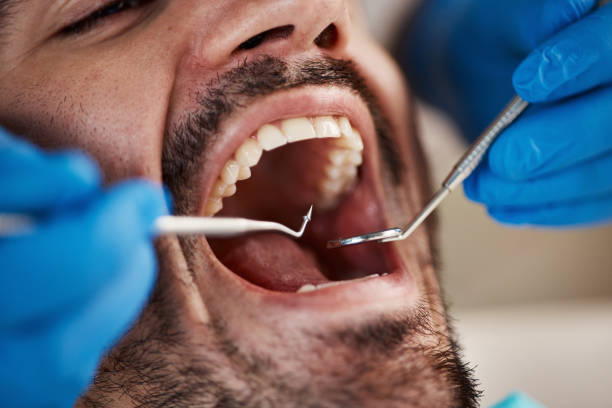 Best Sedation Dentistry  in Nuevo, CA